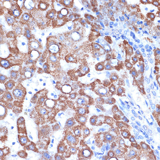 GOT2 Rabbit mAb