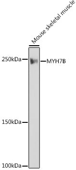 MYH7B Rabbit mAb