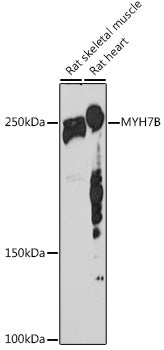 MYH7B Rabbit mAb