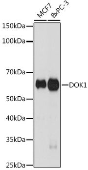 DOK1 Rabbit mAb