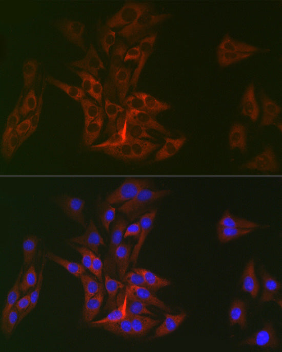 DOK1 Rabbit mAb