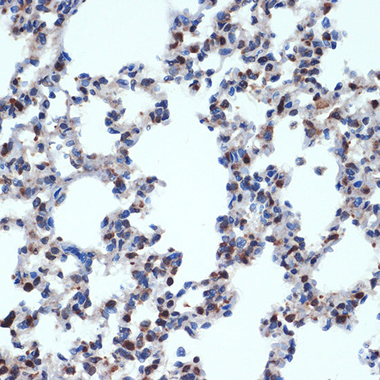 Gemin 2 Rabbit mAb