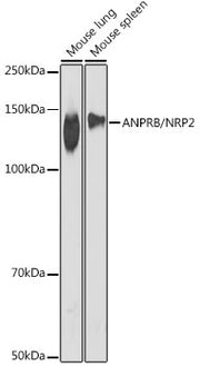 ANPRB/NPR2 Rabbit mAb