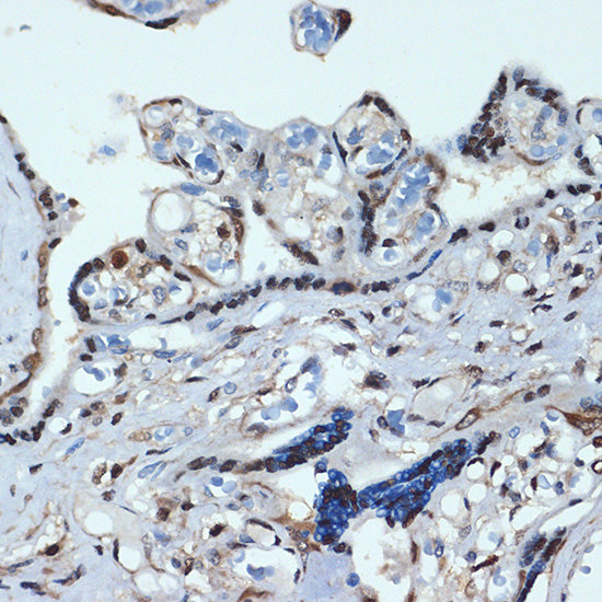 HOXA9 Rabbit mAb