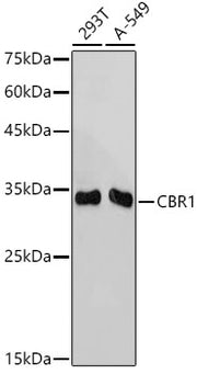 CBR1 Rabbit mAb