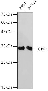 CBR1 Rabbit mAb