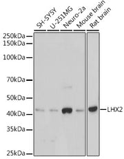 LHX2 Rabbit mAb