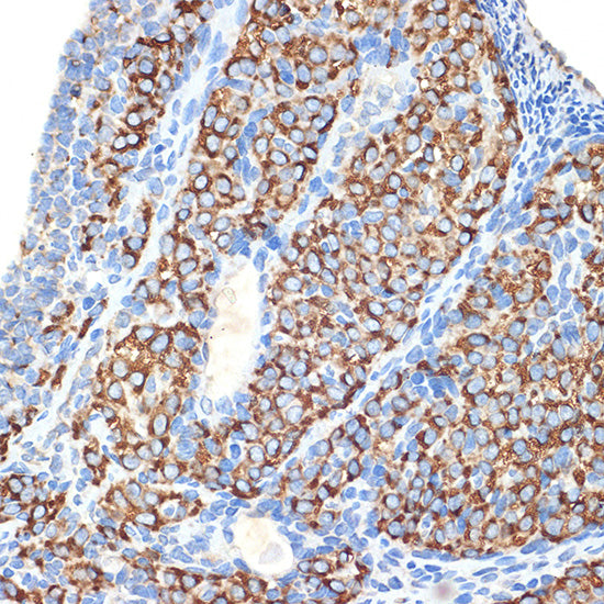 HSD3B1 Rabbit mAb