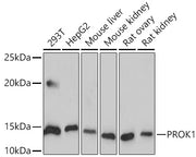 Human EG-VEGF/PK1 Rabbit mAb