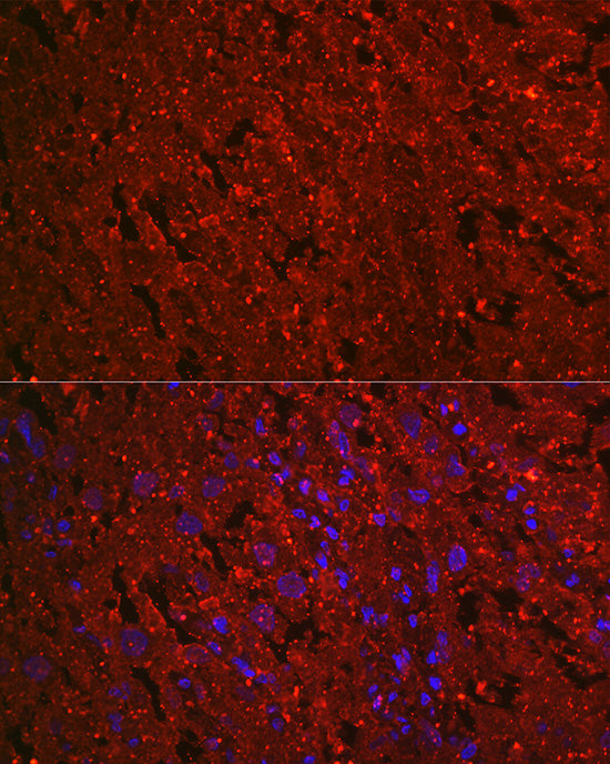 Human EG-VEGF/PK1 Rabbit mAb