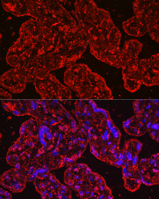 Human EG-VEGF/PK1 Rabbit mAb