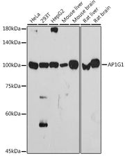 AP1G1 Rabbit mAb