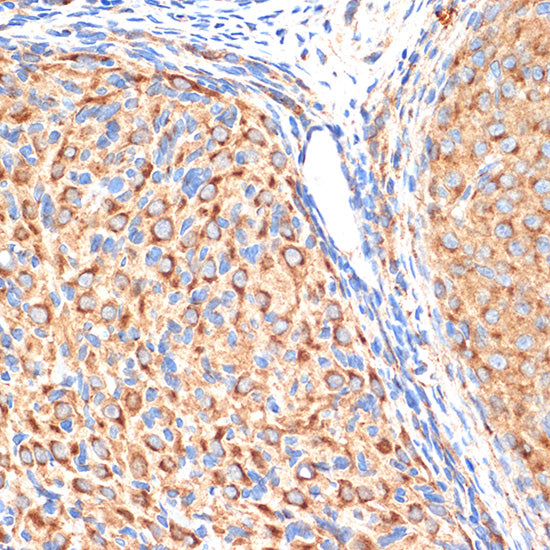 AP1G1 Rabbit mAb