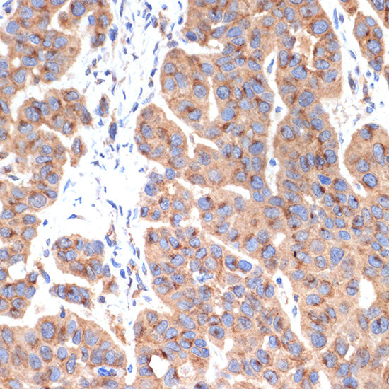 AP1G1 Rabbit mAb