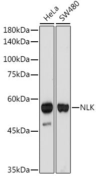 NLK Rabbit mAb