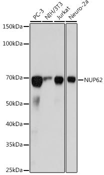 NUP62 Rabbit mAb