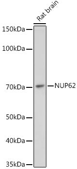 NUP62 Rabbit mAb