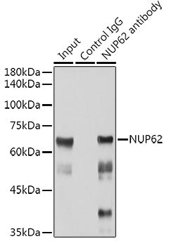 NUP62 Rabbit mAb