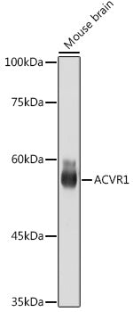 ACVR1 Rabbit mAb