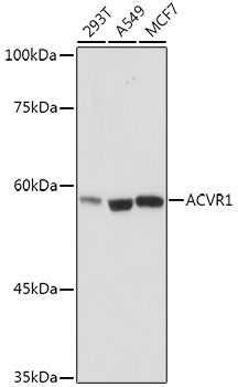 ACVR1 Rabbit mAb