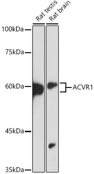 ACVR1 Rabbit mAb