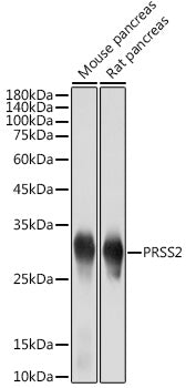 PRSS2 Rabbit mAb