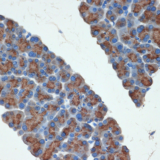 PRSS2 Rabbit mAb