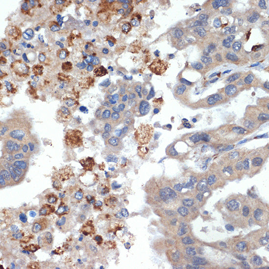 PRSS2 Rabbit mAb