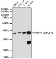 hnRNP E1/PCBP1 Rabbit mAb