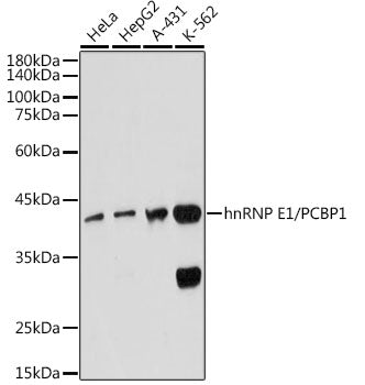 hnRNP E1/PCBP1 Rabbit mAb