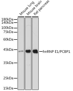 hnRNP E1/PCBP1 Rabbit mAb