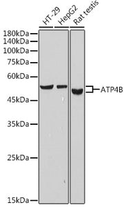 ATP4B Rabbit mAb