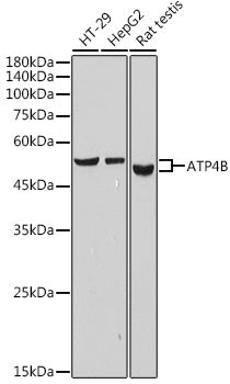 ATP4B Rabbit mAb