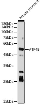 ATP4B Rabbit mAb