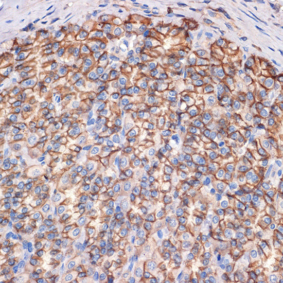 CTNNA3 Rabbit mAb