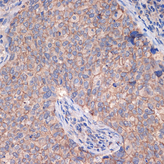 CTNNA3 Rabbit mAb