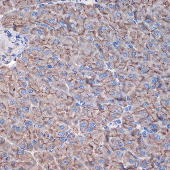 CTNNA3 Rabbit mAb