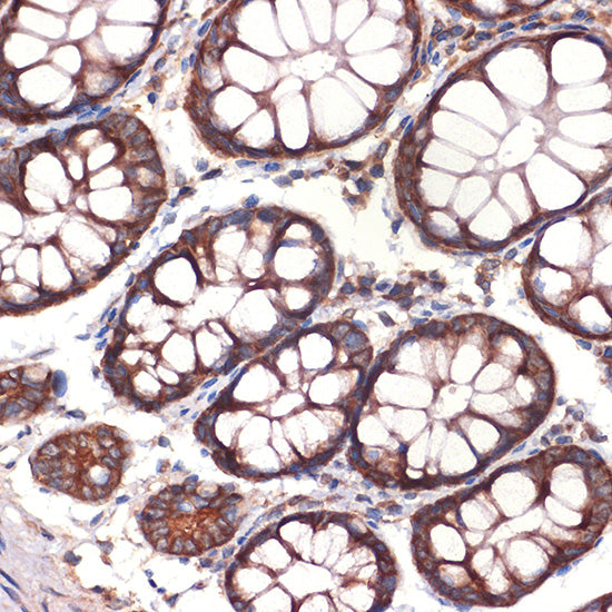 CC2D1A Rabbit mAb