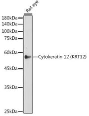 Cytokeratin 12 (KRT12) Rabbit mAb