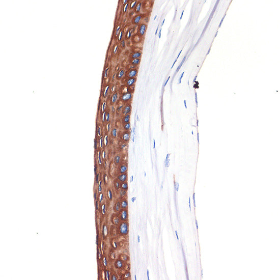 Cytokeratin 12 (KRT12) Rabbit mAb
