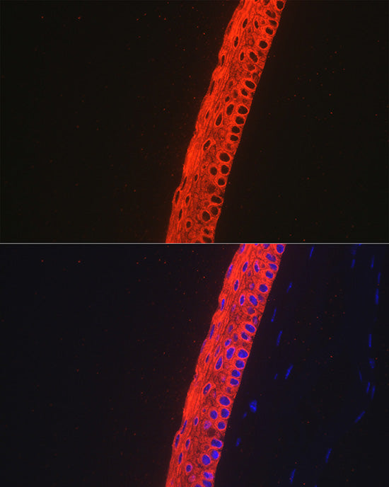 Cytokeratin 12 (KRT12) Rabbit mAb