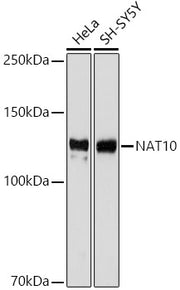 NAT10 Rabbit mAb
