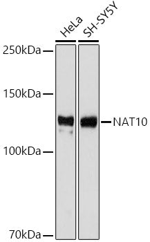 NAT10 Rabbit mAb