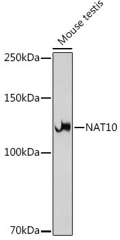 NAT10 Rabbit mAb