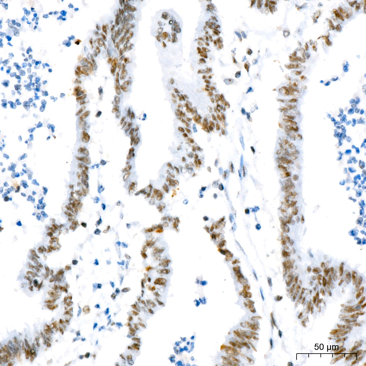 NAT10 Rabbit mAb
