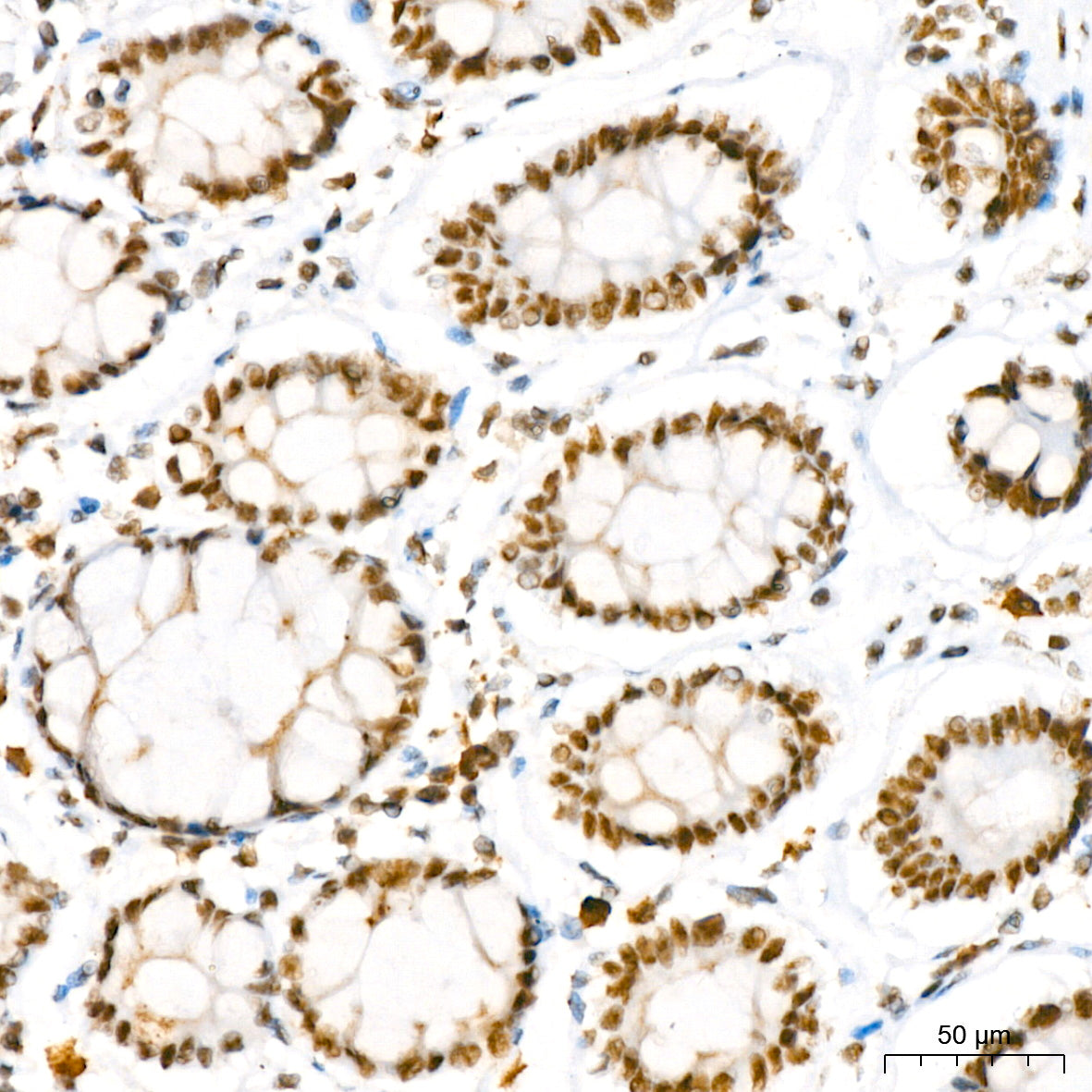 NAT10 Rabbit mAb