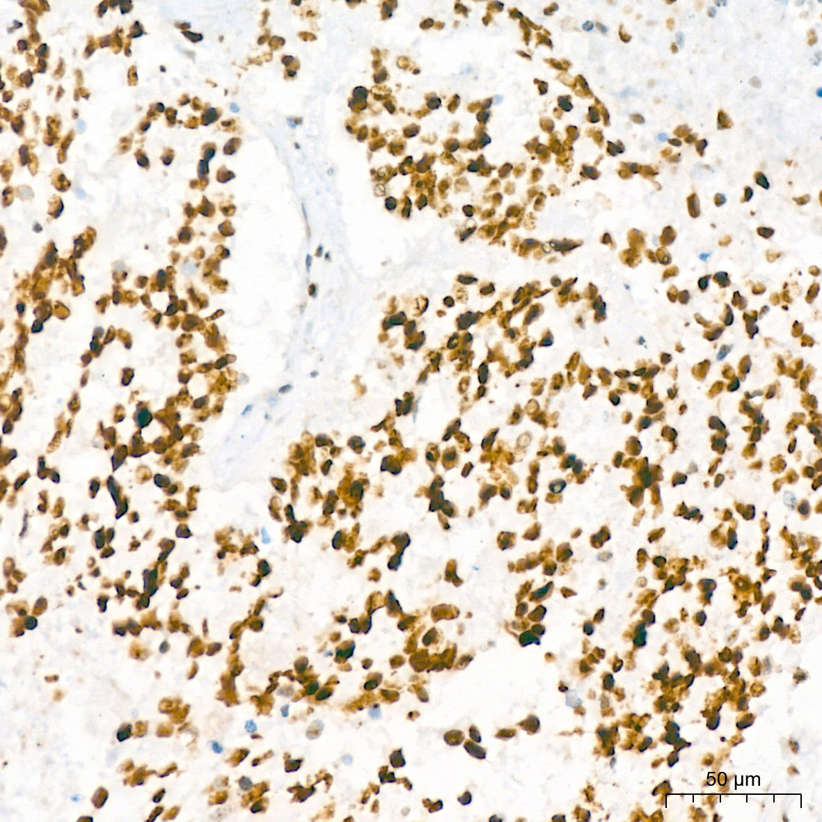 NAT10 Rabbit mAb