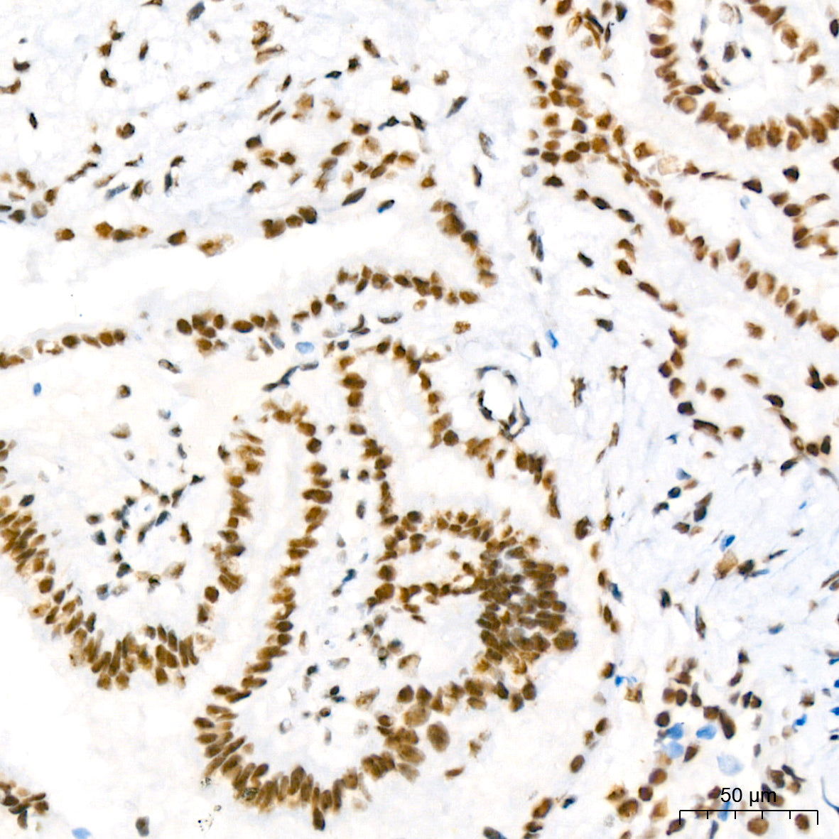NAT10 Rabbit mAb
