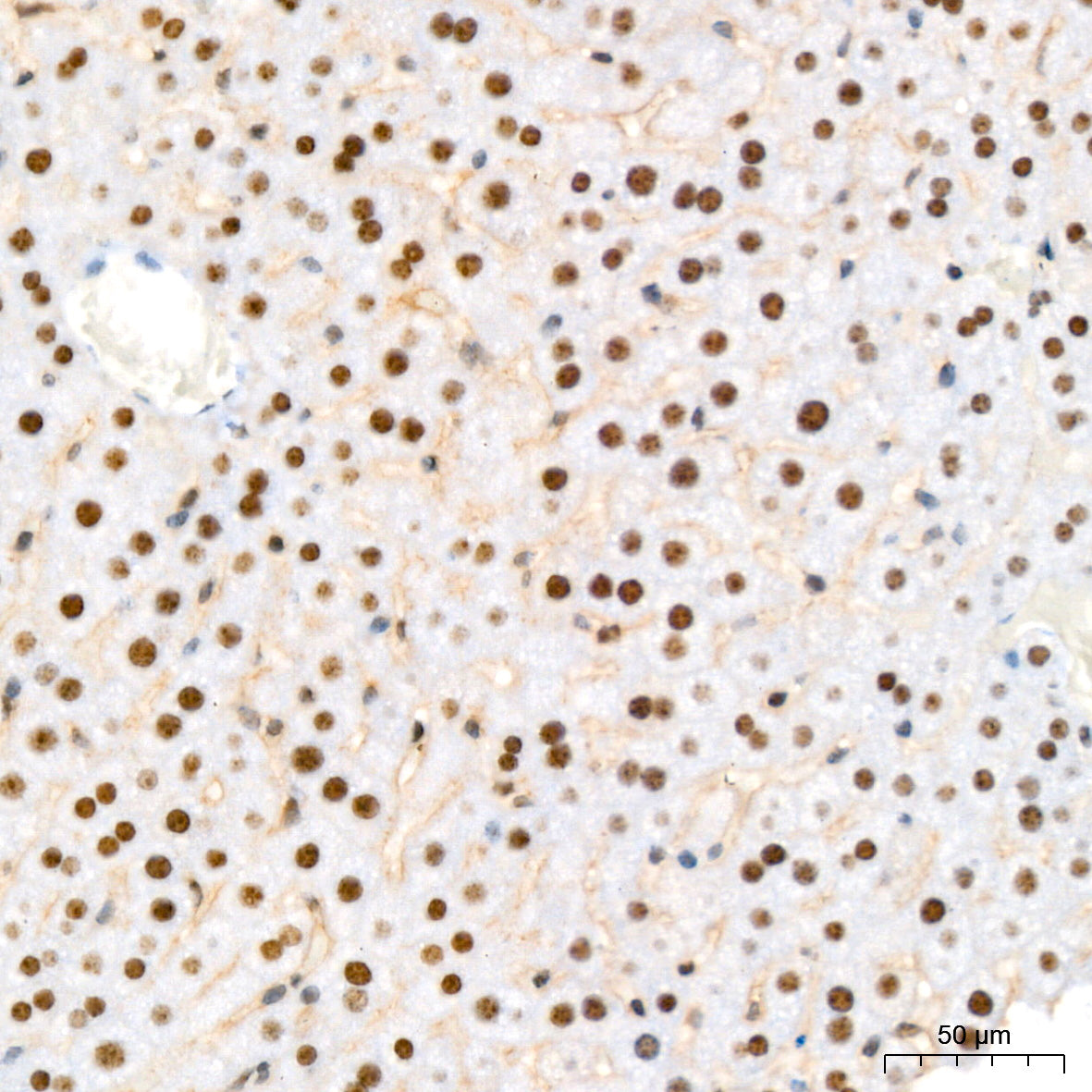 NAT10 Rabbit mAb