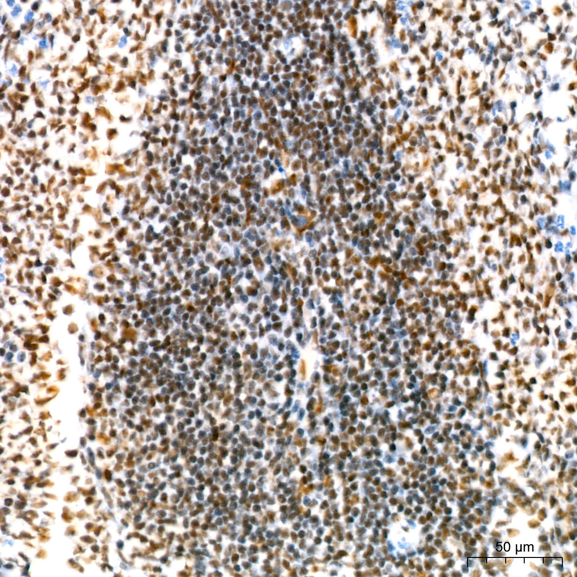 NAT10 Rabbit mAb